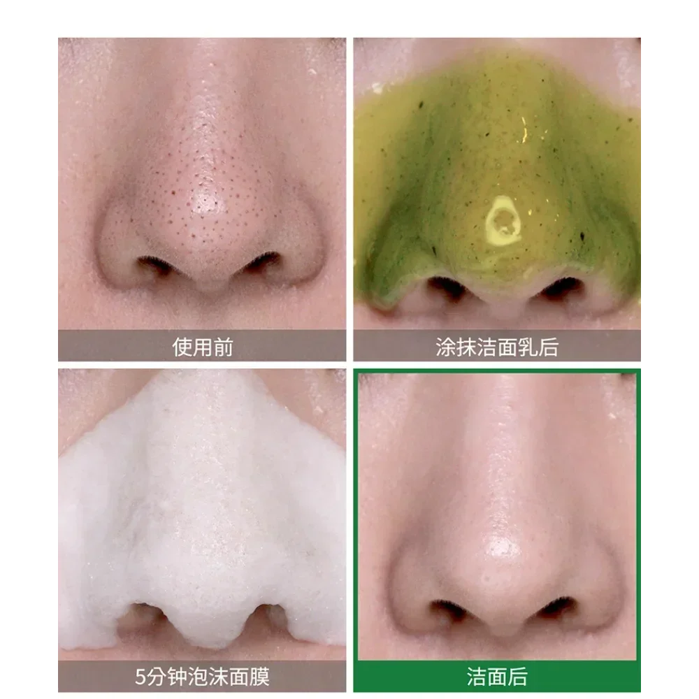 Korea SOME BY MI Bye Bye Black - Skincare Some By Mi recension och pris