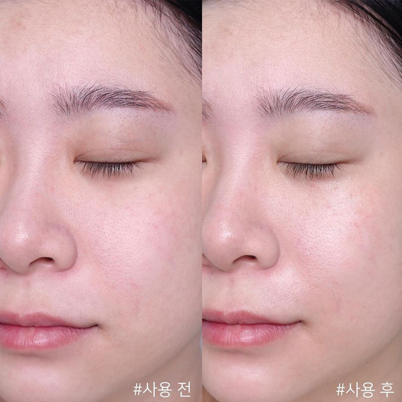 Centella Asiatica Time Reverse - Skincare Centella recension och pris