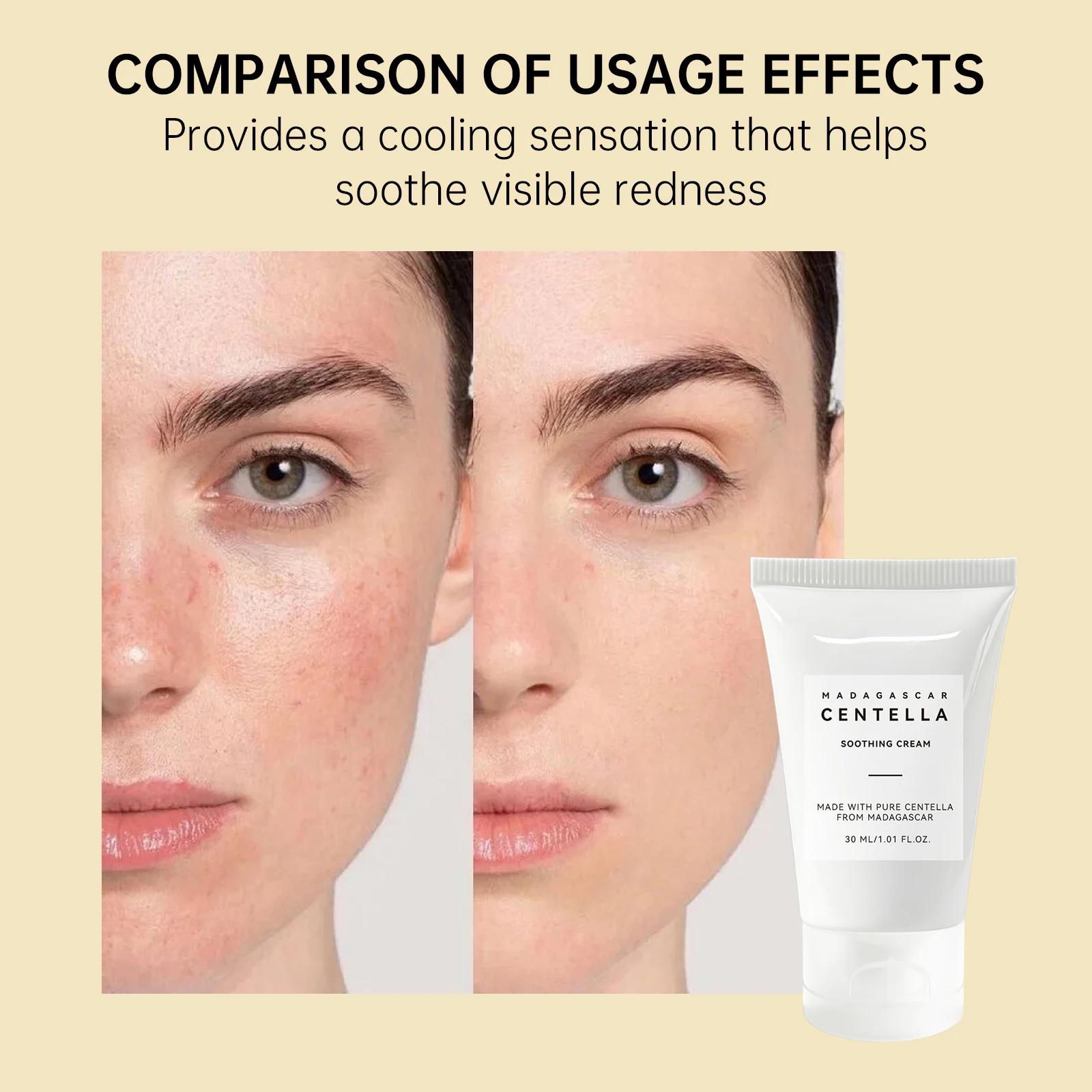 Centella Asiatica Soothing Gel - Skincare Centella recension och pris