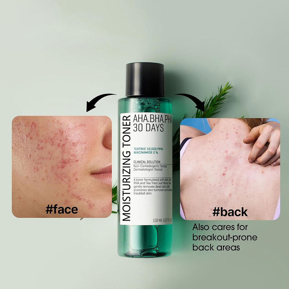 Some by Mi Aha.Bha.Pha 30 Days - Skincare Some By Mi recension och pris